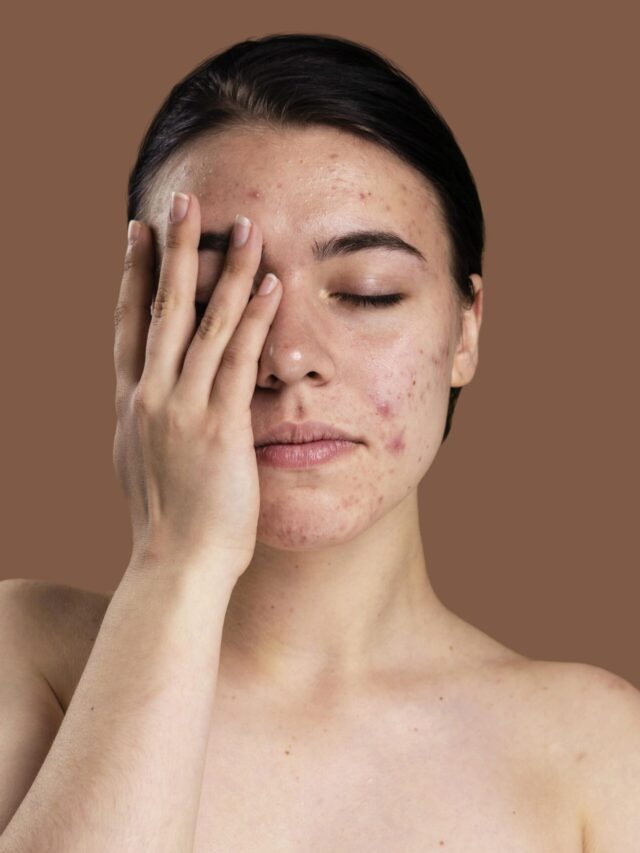 FOODS THAT CAN DAMAGE YOUR SKIN